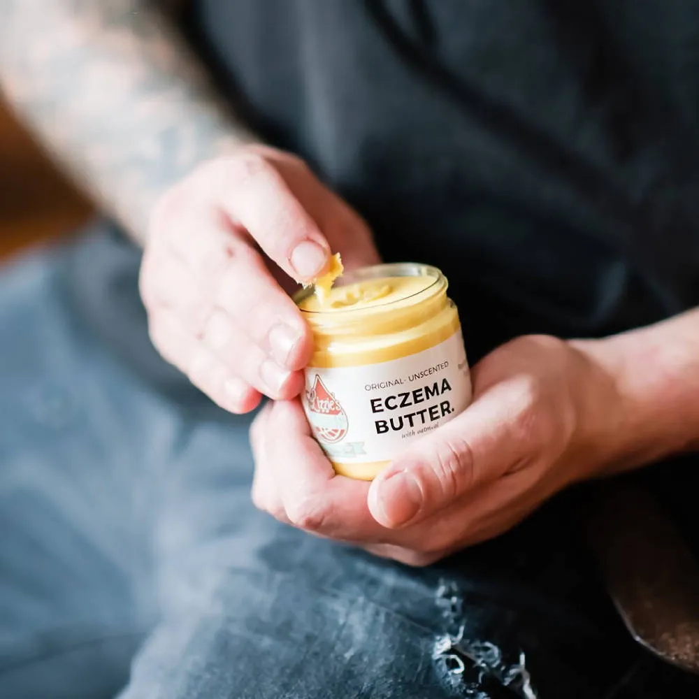 Eczema Butter (3 jar set)